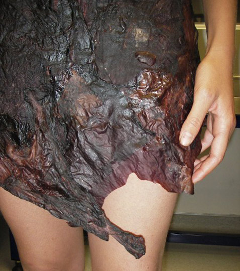      . ,    (   bioalloy.org).