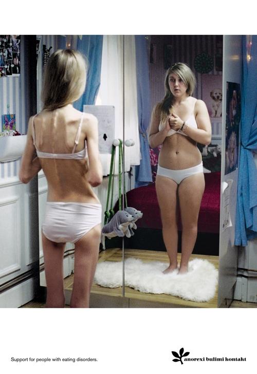Anorexi Bulimi Kontakt