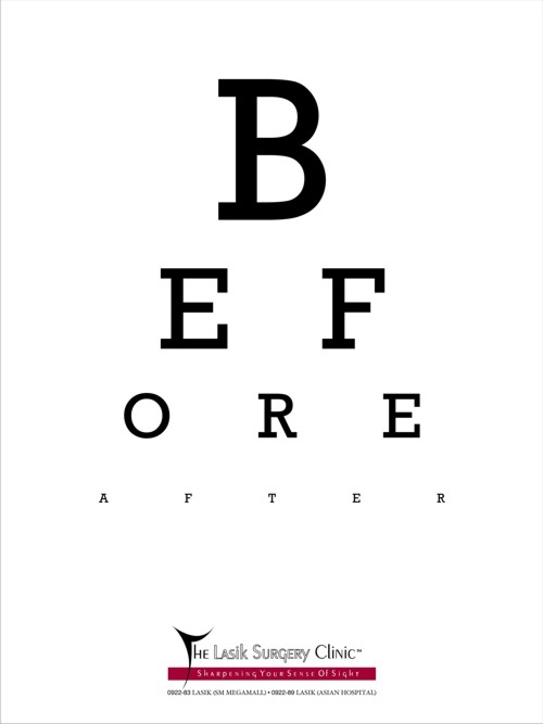    The Lasik Surgery linic